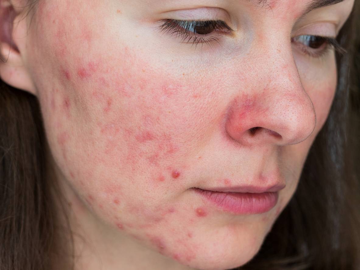 Our 10 best probiotics for skin and gut health