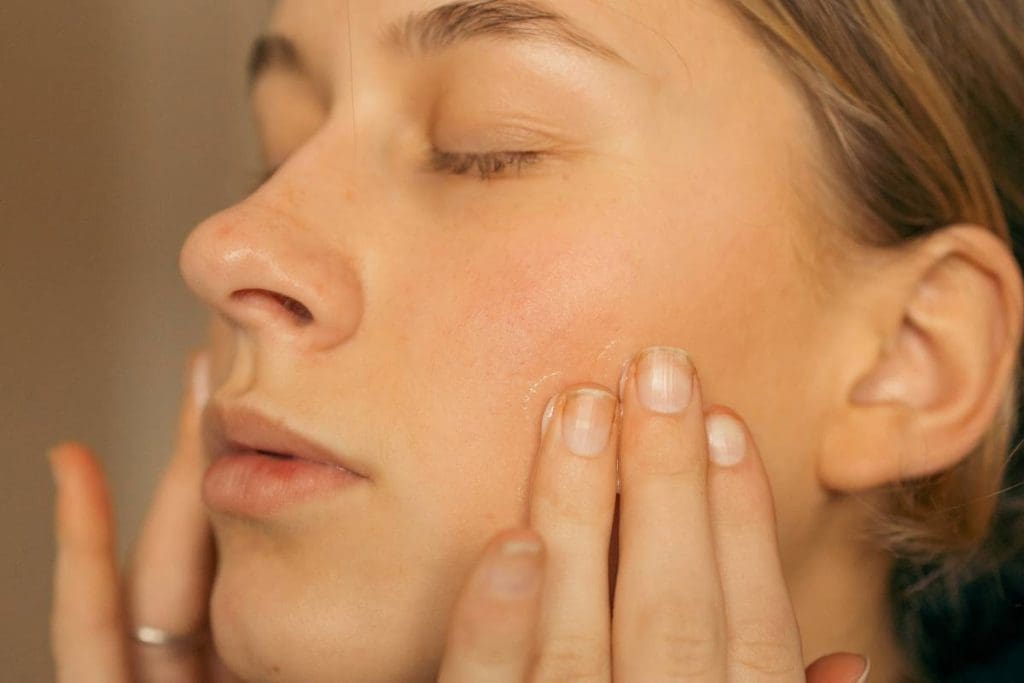 L reuteri skin and stress problems